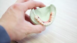 Teeth bridges Dental care